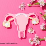 Síndrome de Ovario Poliquístico (SOP)